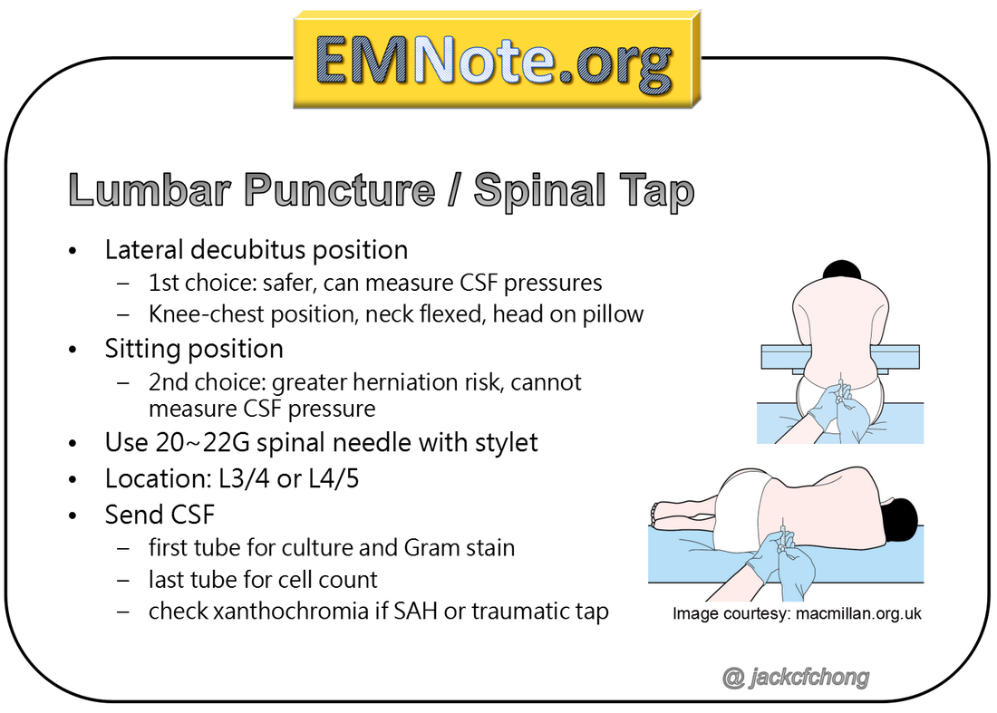 Lumbar Puncture Position